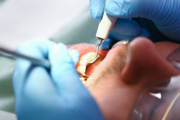 Best Emergency Broken Tooth Repair in Omro, WI