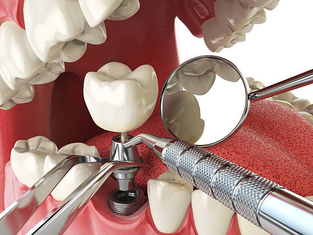 Best Emergency Dental Surgery in Omro, WI